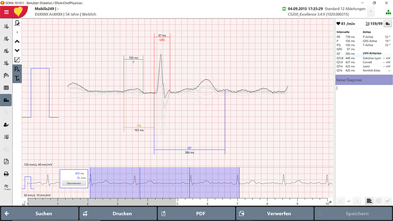 EKG-Vermessung